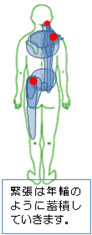 緊張の蓄積現象