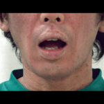 Thumbnail of new posts 004